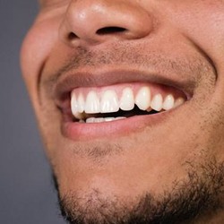 Closeup of man's smile after dental crown restoration