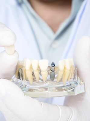 Dentist in white gloves holding sample implant and crown